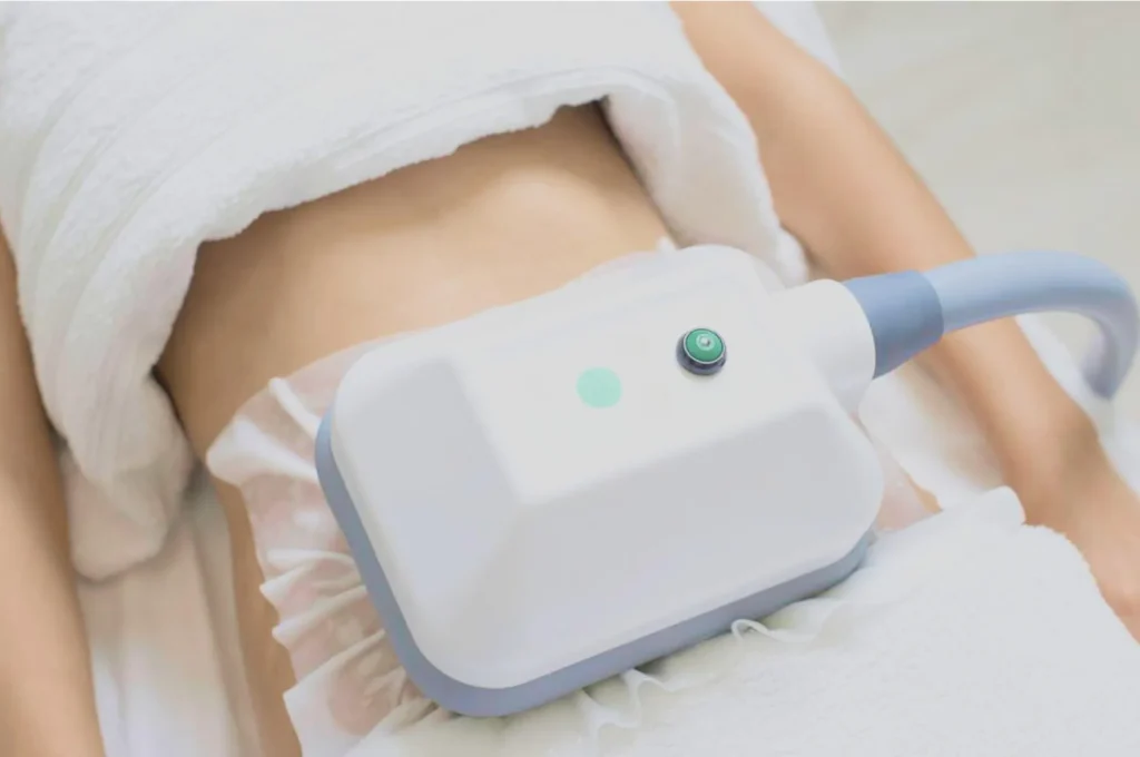 How Fat Freezing and HIFU Work Together? 3 advantages to combining Fat Freezing and HIFU Bellshill