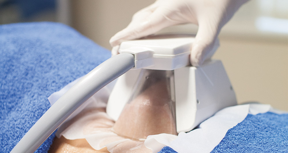 How Fat Freezing and HIFU Work Together? 2 Multiple Areas in One Session HIFU and Fat Freezing Bellshill