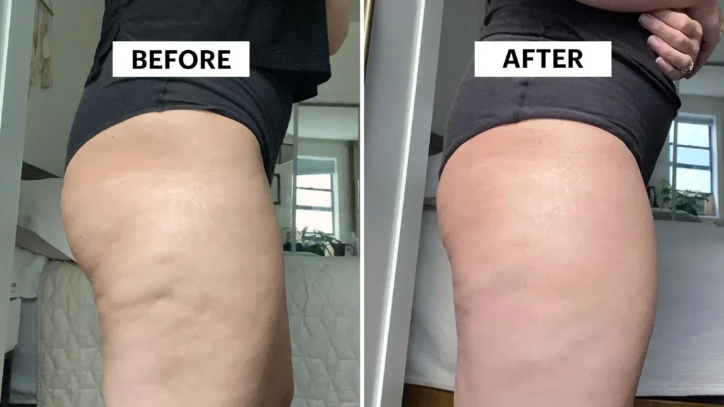 Sculpting Your Bum: Can Toning Exercises Really Reduce Cellulite? 1 Do Toning Exercise Bellshill Really Tackle Cellulite?